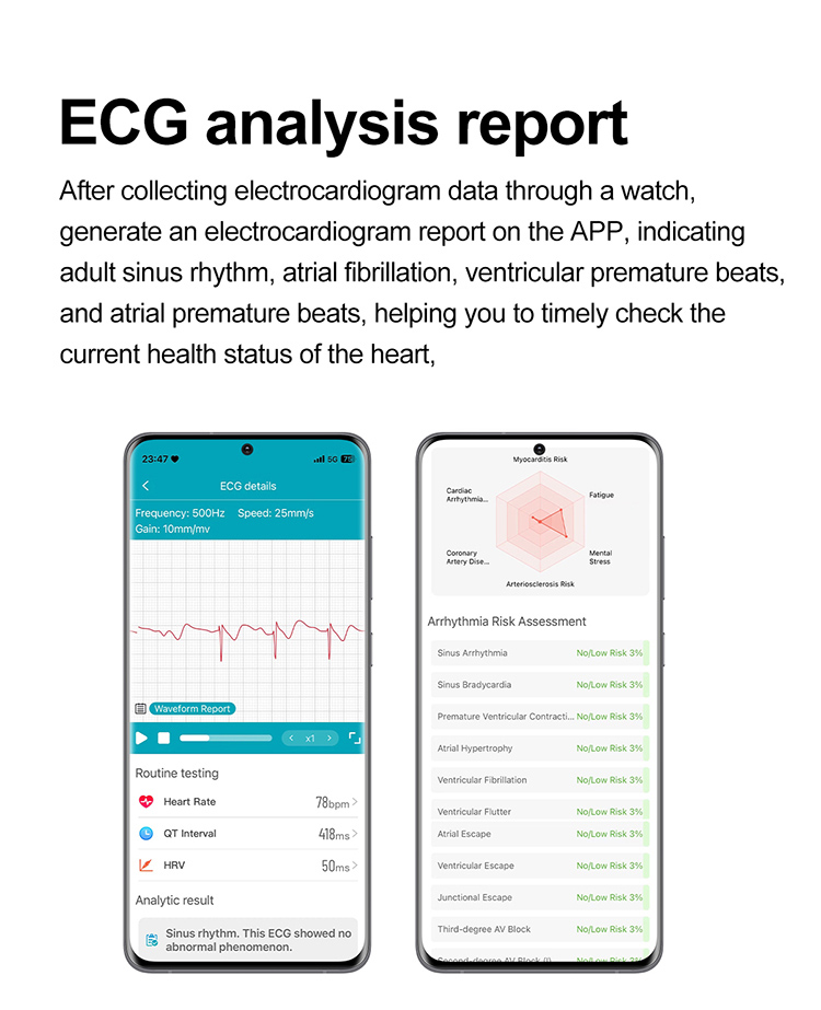 ET593 Smart Watches, Smart Watch ET593, ecg watch smart, et593 smart watch, Smart Watch Square, Health Smart Watch, ECG Smartwatch, IP68 Smart Watch